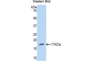 Western blot analysis of the recombinant protein. (NNMT Antikörper  (AA 127-249))