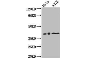 Western Blot Positive WB detected in: Hela whole cell lysate, A375 whole cell lysate All lanes: EDG2 antibody at 1:1000 Secondary Goat polyclonal to rabbit IgG at 1/50000 dilution Predicted band size: 42, 42 kDa Observed band size: 42 kDa (Rekombinanter LPAR1 Antikörper)