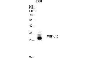 Western Blot (WB) analysis of 293T lysis using MRP-L10 antibody. (MRPL10 Antikörper  (C-Term))