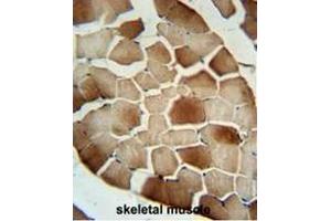 CFB Antibody (Center) immunohistochemistry analysis in formalin fixed and paraffin embedded human skeletal muscle followed by peroxidase conjugation of the secondary antibody and DAB staining. (Complement Factor B Antikörper  (Middle Region))