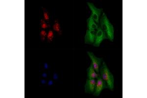 ABIN6264185 and ABIN6279642 staining  cells by IF/ICC. (PHOX2B Antikörper  (Internal Region))