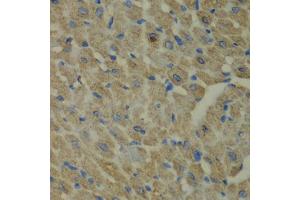 Immunohistochemistry of paraffin-embedded mouse heart using CCBL1 antibody (ABIN5973926) at dilution of 1/100 (40x lens). (CCBL1 Antikörper)