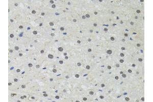 Immunohistochemistry of paraffin-embedded rat liver using PPP4C antibody. (PPP4C Antikörper)
