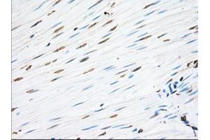 Immunohistochemical staining of paraffin-embedded Human Kidney tissue using anti-EIF2S1 mouse monoclonal antibody. (EIF2S1 Antikörper)