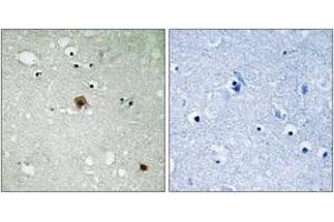 Immunohistochemistry analysis of paraffin-embedded human brain, using TOP2A (Phospho-Ser1525) Antibody. (Topoisomerase II alpha Antikörper  (pSer1525))