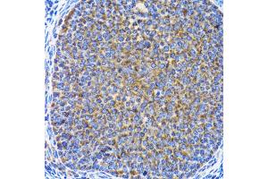 Immunohistochemistry of paraffin-embedded rat ovary using MAP1LC3A antibody. (MAP1LC3A Antikörper)