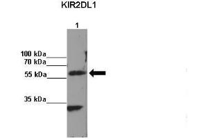 Amount and Sample Type: Lane 1:2x107 KIR2DL1 transfected NKL cells IP Antibody: KIR2DL1 Amount of IP Antibody: Primary Antibody: KIR2DL1 Primary Antibody Dilution: 1: x50Secondary Antibody: Anti-rabbit-HRP Secondary Antibody Dilution: 1:x0,000  Gene Name: KIR2DL1 Submitted by: Kerry S.