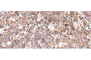 Immunohistochemistry of paraffin-embedded Human tonsil tissue using KBTBD11 Polyclonal Antibody at dilution of 1:35(x200) (KBTBD11 Antikörper)