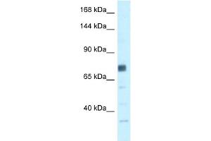 WB Suggested Anti-BRCA1 Antibody Titration: 0. (BRCA1 Antikörper  (N-Term))