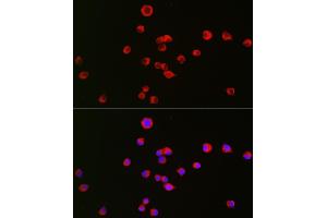Immunofluorescence analysis of Neuro-2a cells using OPRK1 Rabbit pAb (ABIN6134089, ABIN6145043, ABIN6145045 and ABIN6218249) at dilution of 1:50 (40x lens). (OPRK1 Antikörper  (C-Term))