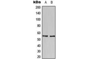 Western blot analysis of HBP1 expression in SKBR3 (A), U937 (B) whole cell lysates. (HBP1 Antikörper  (C-Term))