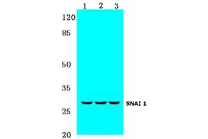 Western blot (WB) analysis of SNAI 1 antibody at 1/500 dilution: (SNAIL Antikörper)