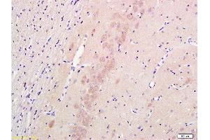 Formalin-fixed and paraffin embedded rat hippocampus labeled with Anti-Nestin Polyclonal Antibody , Unconjugated 1:300 followed by conjugation to the secondary antibody and DAB staining (Nestin Antikörper  (AA 681-750))