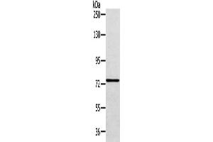 Gel: 6 % SDS-PAGE, Lysate: 40 μg, Lane: A172 cell, Primary antibody: ABIN7131591(VPS53 Antibody) at dilution 1/200 dilution, Secondary antibody: Goat anti rabbit IgG at 1/8000 dilution, Exposure time: 30 seconds (VPS53 Antikörper)