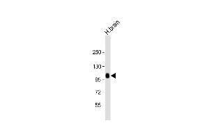 Anti-ADTS17 Antibody (N-term) at 1:2000 dilution + human brain lysate Lysates/proteins at 20 μg per lane.