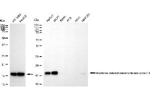 Western blotting analysis using interferon induced transmembrane protein 3 antibody (ABIN7799091).
