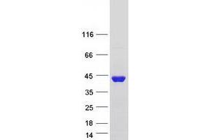Validation with Western Blot (BEND6 Protein (Myc-DYKDDDDK Tag))