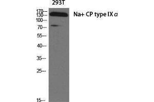 Western Blotting (WB) image for anti-Sodium Channel, Voltage-Gated, Type IX, alpha Subunit (SCN9A) (Internal Region) antibody (ABIN3185755)