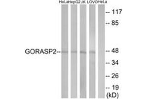 Western blot analysis of extracts from HeLa/HepG2/Jurkat/LOVO cells, using GORASP2 Antibody. (GORASP2 Antikörper  (AA 181-230))