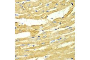 Immunohistochemistry of paraffin-embedded rat heart using OGT antibody at dilution of 1:100 (x40 lens).