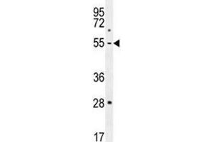 MMP1 antibody western blot analysis in MDA-MB231 lysate.