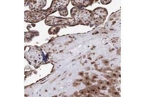 Immunohistochemical staining of human placenta with ZNF655 polyclonal antibody  shows strong nuclear positivity in trophoblastic cells at 1:200-1:500 dilution. (ZNF655 Antikörper)