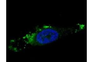 Fluorescent image of chloroquine-treated U251 cells stained with ATG12 antibody. (ATG12 Antikörper  (AA 1-30))