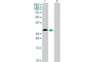 Western Blot analysis of TFPI2 expression in transfected 293T cell line by TFPI2 MaxPab polyclonal antibody. (TFPI2 Antikörper  (AA 1-235))