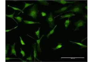 Immunofluorescence of monoclonal antibody to PURA on HeLa cell. (PURA Antikörper  (AA 183-292))