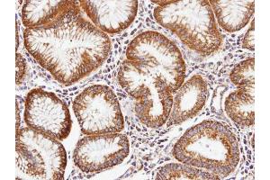 Immunohistochemistry (IHC) image for anti-Periostin (POSTN) (C-Term) antibody (ABIN2854805)