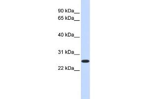 WB Suggested Anti-DULLARD Antibody Titration:  0. (CTDNEP1A Antikörper  (Middle Region))