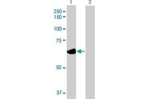 Western Blot analysis of DTNB expression in transfected 293T cell line by DTNB MaxPab polyclonal antibody. (Dystrobrevin beta Antikörper  (AA 1-609))