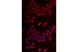 Immunofluorescence analysis of A549 cell using FLCN antibody.