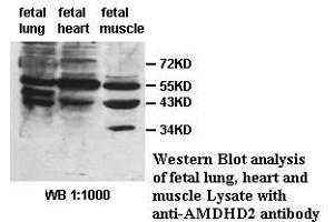 Image no. 1 for anti-Amidohydrolase Domain Containing 2 (AMDHD2) antibody (ABIN1574657) (AMDHD2 Antikörper)