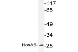 Western blot (WB) analysis of HoxA6 antibody in extracts from K562 cells. (HOXA6 Antikörper)