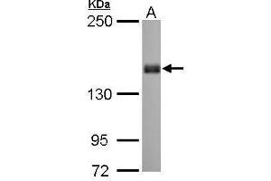 WB Image Liprin alpha 1 antibody [N1N2], N-term detects PPFIA1 protein by Western blot analysis. (PPFIA1 Antikörper  (N-Term))