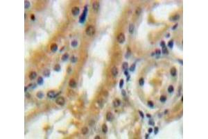 IHC-P analysis of Kidney tissue, with DAB staining. (Betacellulin Antikörper  (AA 32-118))