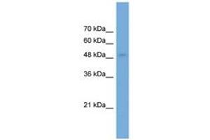 Image no. 1 for anti-Neuronal Pentraxin II (NPTX2) (AA 179-228) antibody (ABIN6746446) (NPTX2 Antikörper  (AA 179-228))