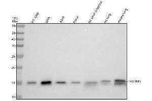 Western blot analysis of TAX1BP3 using anti-TAX1BP3 antibody (ABIN7606447).