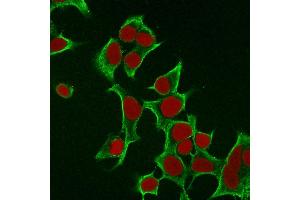 Immunofluorescence Analysis of MCF cells labeling Cytokeratin 8 withKRT8 Mouse Monoclonal Antibody (B22.