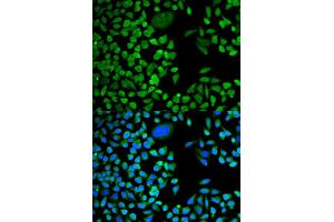 Immunofluorescence (IF) image for anti-TIA1 Cytotoxic Granule-Associated RNA Binding Protein (TIA1) antibody (ABIN1882364)