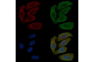 ABIN6262754 and ABIN6279215 staining Hela cells(30 min of UV treatment) by IF/ICC.