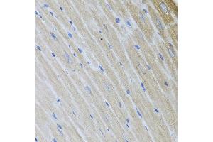 Immunohistochemistry of paraffin-embedded mouse heart using USP25 antibody at dilution of 1:100 (x40 lens).
