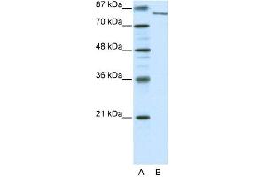 WB Suggested Anti-FBXL11 Antibody Titration: 0.