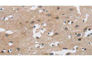 Immunohistochemistry of paraffin-embedded Human brain using FGF9 Polyclonal Antibody at dilution of 1:40 (FGF9 Antikörper)
