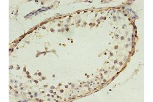 Immunohistochemistry of paraffin-embedded human testis tissue using ABIN7159264 at dilution of 1:100 (MAGEA4 Antikörper  (AA 1-270))