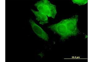 Immunofluorescence of purified MaxPab antibody to ECH1 on HeLa cell. (ECH1 Antikörper  (AA 1-328))