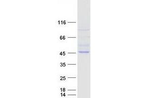 Validation with Western Blot (RAPSN Protein (Transcript Variant 1) (Myc-DYKDDDDK Tag))