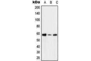 Western blot analysis of PFKFB2 (pS483) expression in HeLa H2O2-treated (A), SP2/0 H2O2-treated (B), H9C2 H2O2-treated (C) whole cell lysates. (PFKFB2 Antikörper  (C-Term, pSer483))