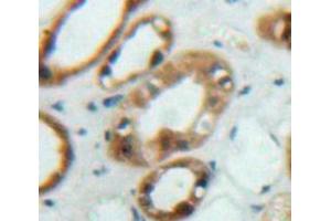 Used in DAB staining on fromalin fixed paraffin-embedded Kidney tissue (FRS2 Antikörper  (AA 268-453))